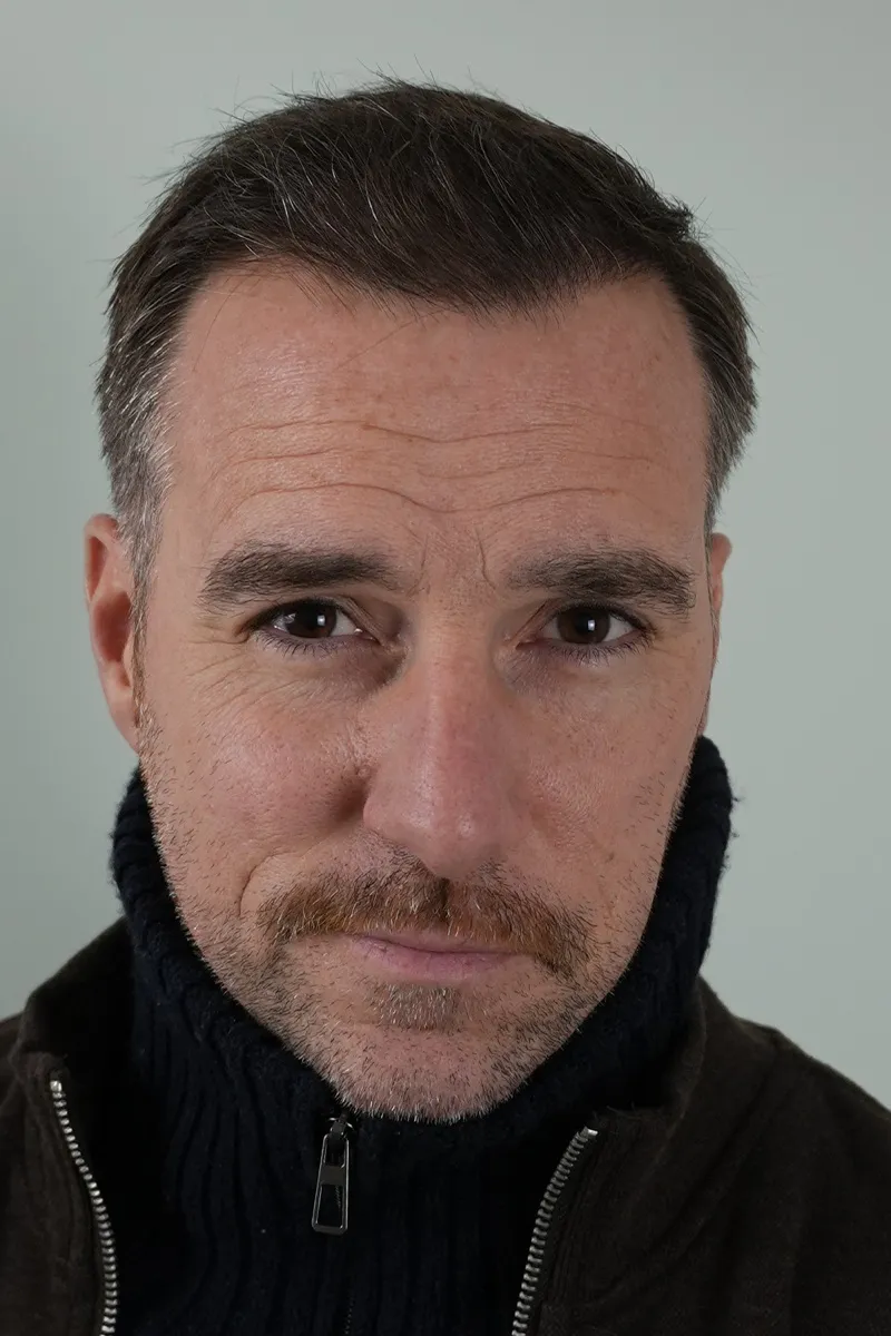 Après R.