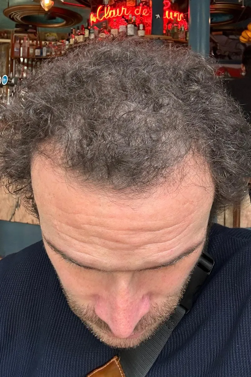 Avant J.